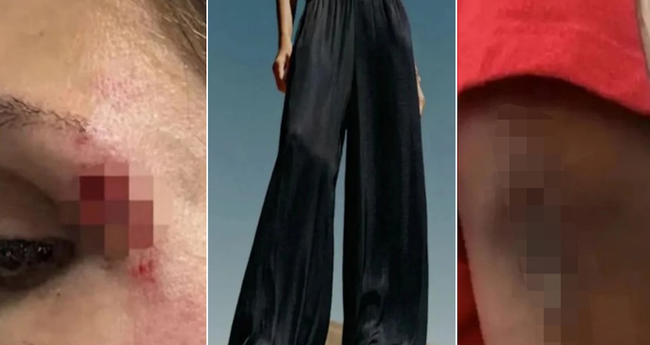Moda akımı kabusa dönüştü: Bu pantolonu giyen yere düşüyor